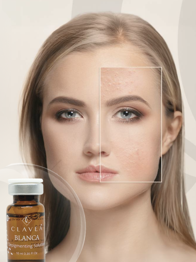 Blanca Brightening Facial by Clavea
