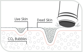 Illustration of exfoliation step