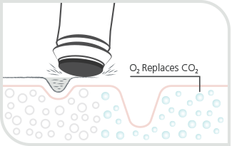 Illustration of infusion step